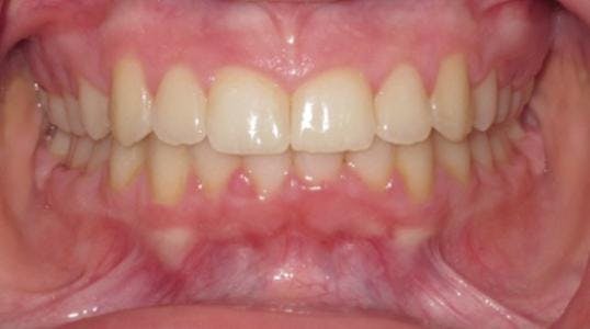 Case 1 After Picture