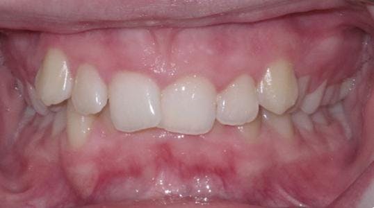 Case 1 Before Picture