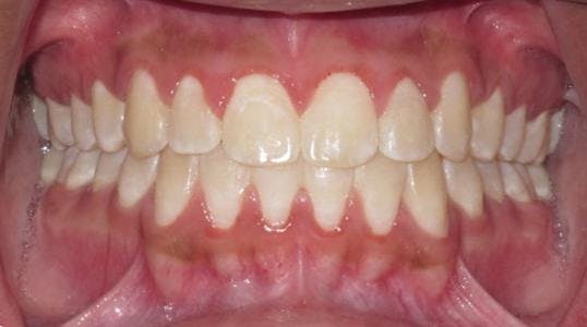 Case 2 After Picture