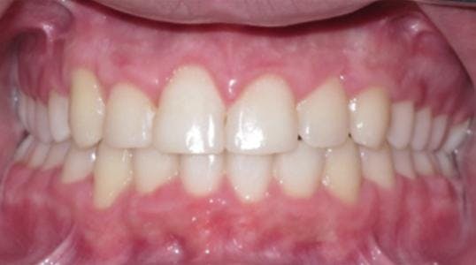 Case 3 After Picture