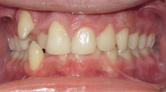 Case 3 Before Picture