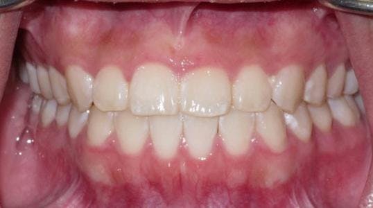 Case 4 After Picture