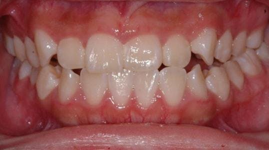 Case 4 Before Picture