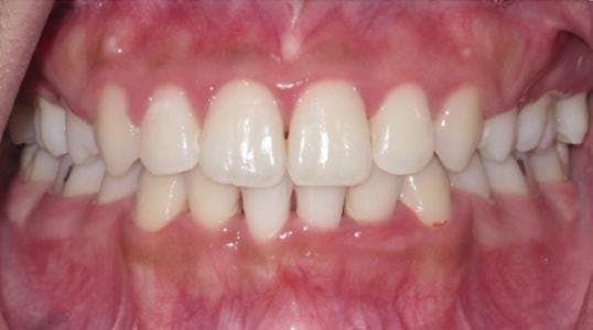 Case 5 After Picture