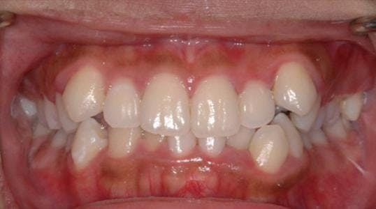 Case 5 Before Picture