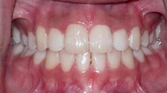 Case 6 After Picture