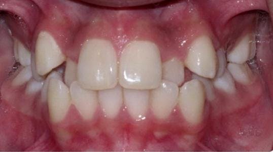 Case 6 Before Picture