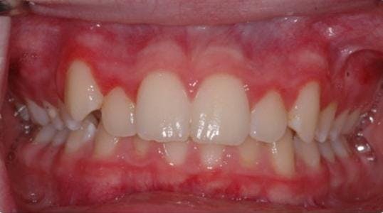 Case 7 Before Picture