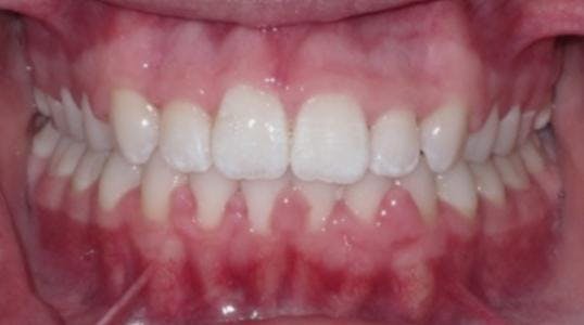 Case 8 After Picture