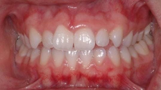 Case 8 Before Picture